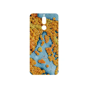 MAHOOT Atom Universe 7 Cover Sticker for Huawei Mate 10 Lite