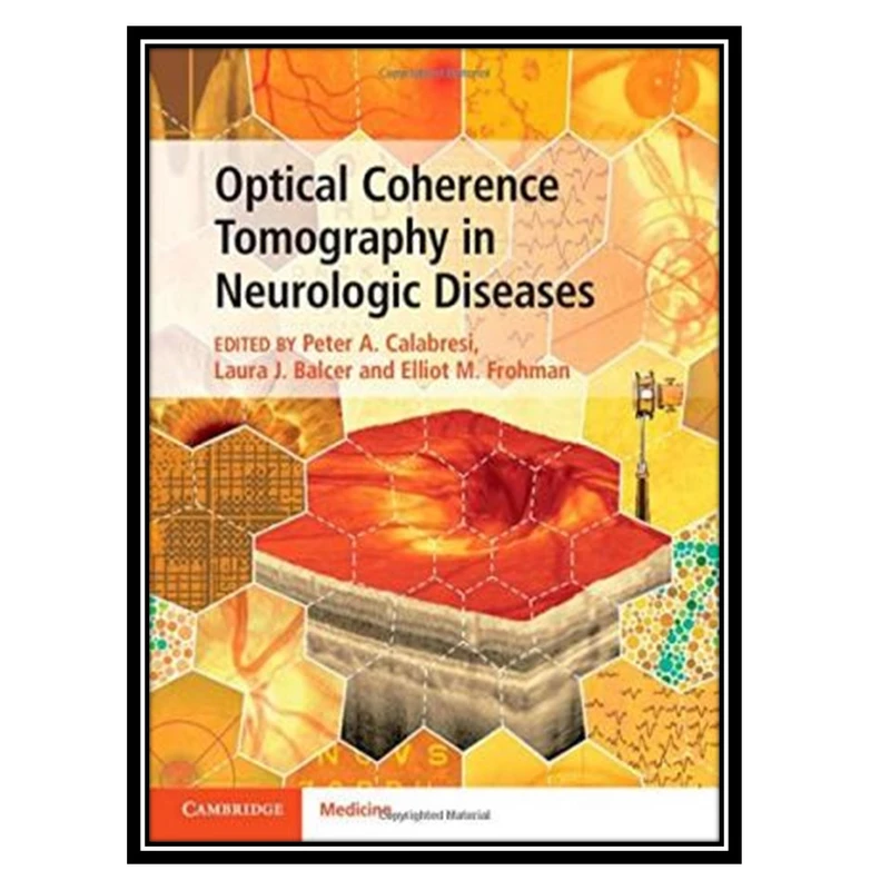 کتاب Optical Coherence Tomography in Neurologic Diseases اثر جمعی از نویسندگان انتشارات مؤلفین طلایی