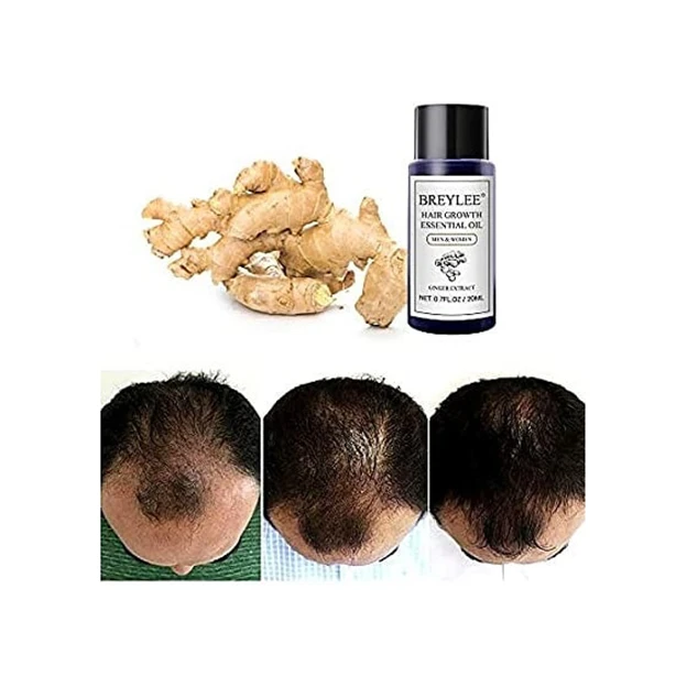 عکس شماره 3 : روغن ضد ریزش مو بریلی مدل جنسینگ حجم 20 میلی لیتر