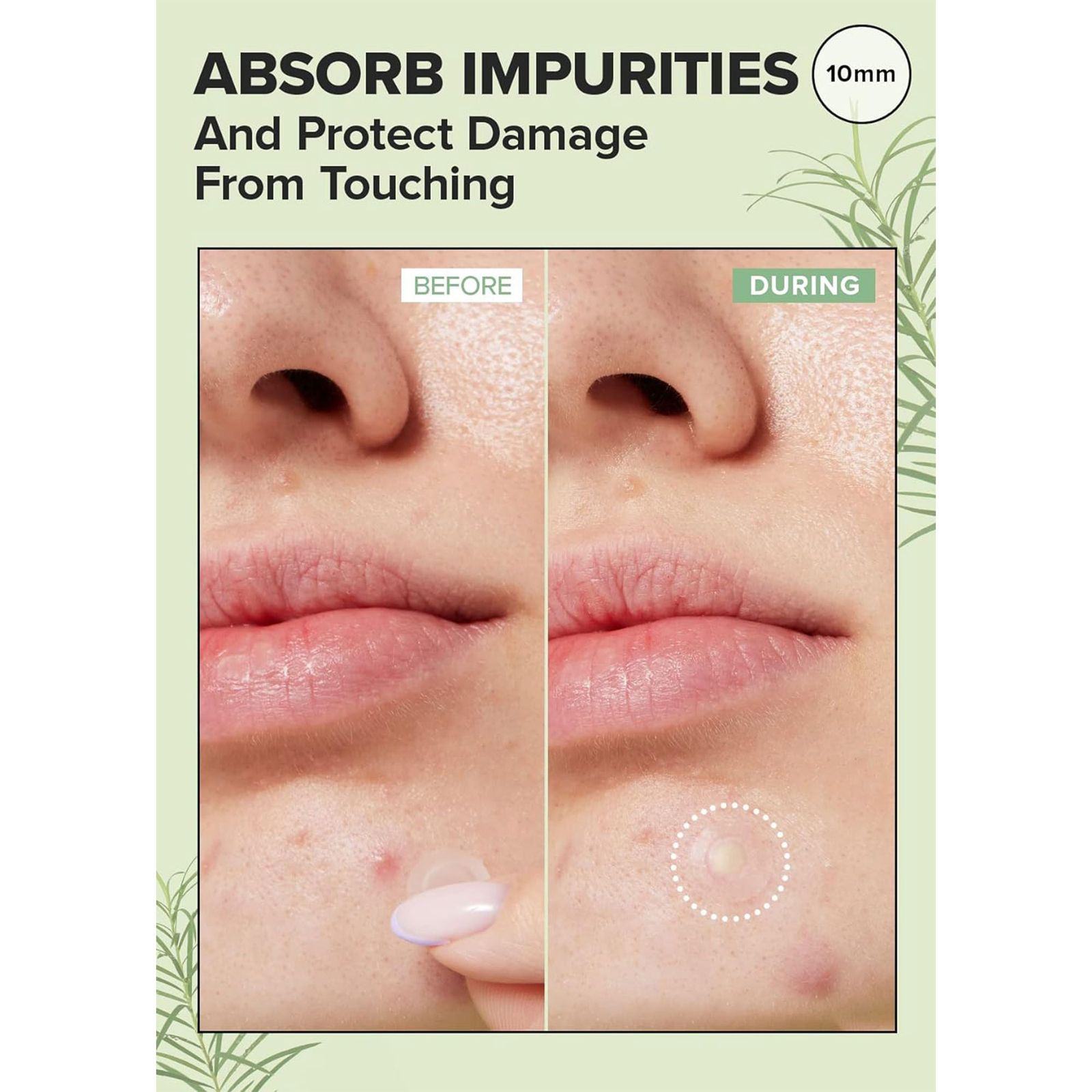 چسب ضد جوش پنرول مدل PRD Acne Cover Patch 360 بسته 36 عددی -  - 6