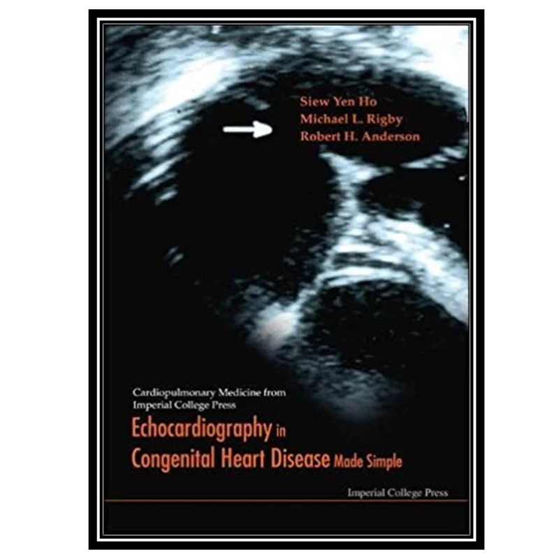 کتاب Echocardiography in Congenital Heart Disease Made Simple اثر جمعی از نویسندگان انتشارات مؤلفین طلایی