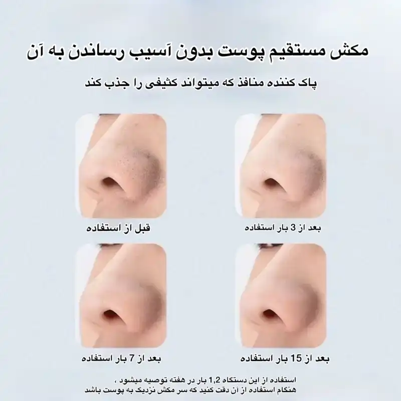 میکرودرم مدل E20