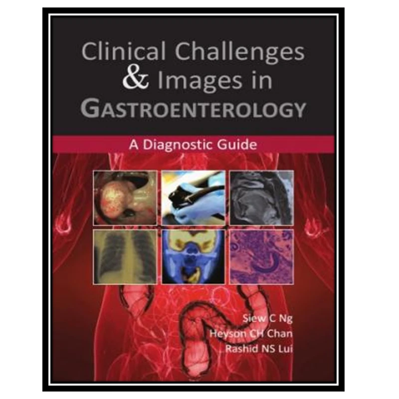 کتاب Clinical Challenges & Images in Gastroenterology: A Diagnostic Guide اثر جمعی از نویسندگان انتشارات مؤلفین طلایی