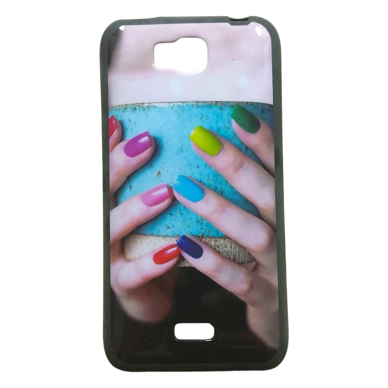 کاور رکسر  مدل 80033 مناسب برای گوشی موبایل آنر BEE