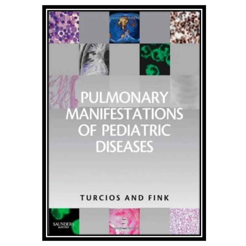 کتاب Pulmonary Manifestations of Pediatric Diseases اثر Nelson L. Turcios MD and Robert J. Fink MD انتشارات مؤلفین طلایی