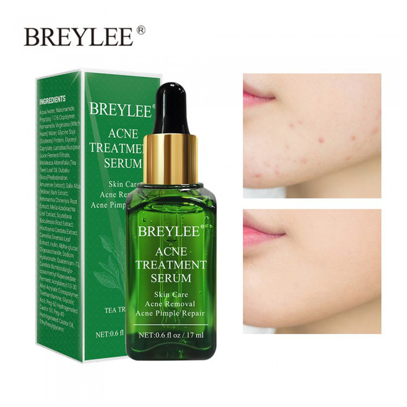 سرم ضد جوش بریلی مدل چای سبز حجم 17 میلی لیتر