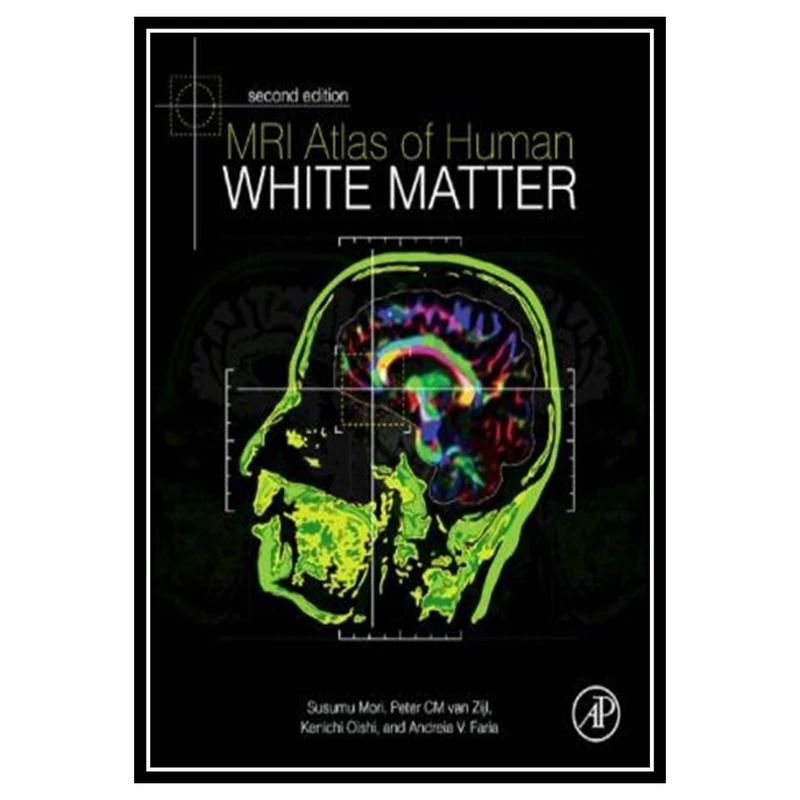 کتاب MRI Atlas of Human White Matter اثر جمعی از نویسندگان انتشارات مؤلفین طلایی