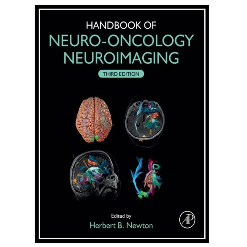 کتاب Handbook of Neuro-Oncology Neuroimaging اثر Herbert B. Newton انتشارات مؤلفین طلایی