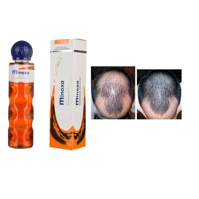 شامپو ضد ریزش مو ویرگو مدل ماینوکسا حجم 220 میلی لیتر بسته 4 عددی