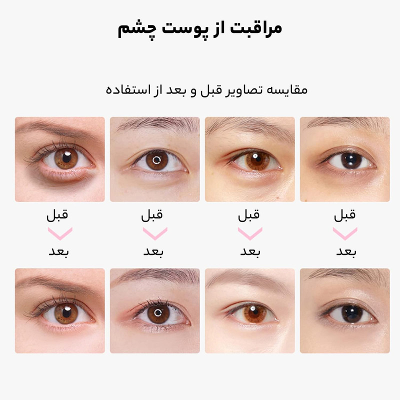 ماسک زیر چشم بایو آکوا مدل nonapeptide آبرسان قوی، مرطوب‌کننده، ضدچین و چروک، کاهش پف و تیرگی، تحریک کلاژن‌سازی، نرم‌کننده پوست حجم 7.5 میلی‌لیتر