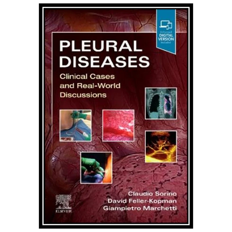 کتاب Pleural Diseases: Clinical Cases and Real-World Discussions اثر جمعی از نویسندگان انتشارات مؤلفین طلایی