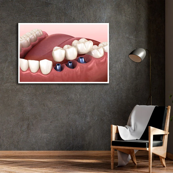 تابلو بکلیت طرح دندانپزشکی مدل W-D2200 فریم سفید