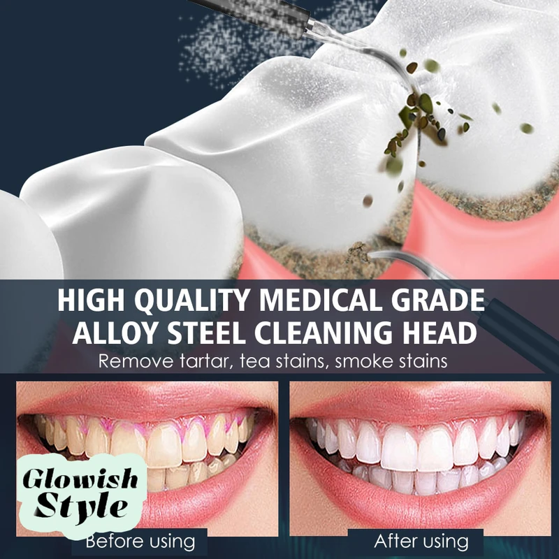 عکس شماره 6 : مسواک برقی گلویش استایل مدل 7in1