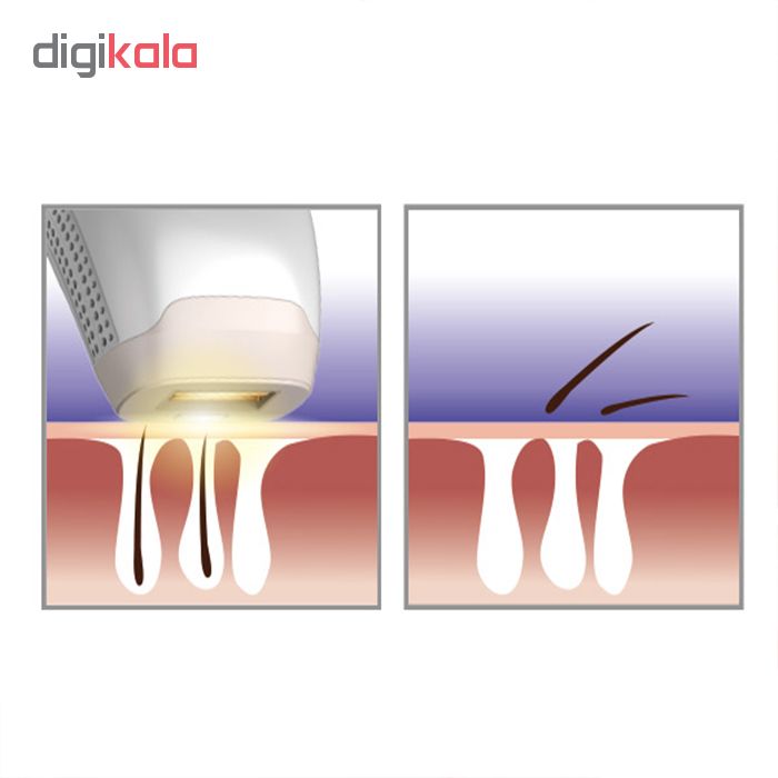 لیزر موهای زائد تاچ بیوتی مدل TB1755 -  - 9