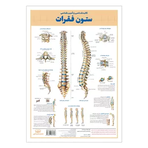 پوستر آموزشی انتشارات اندیشه کهن مدل کالبدشناسی و آسیب شناسی ستون فقرات