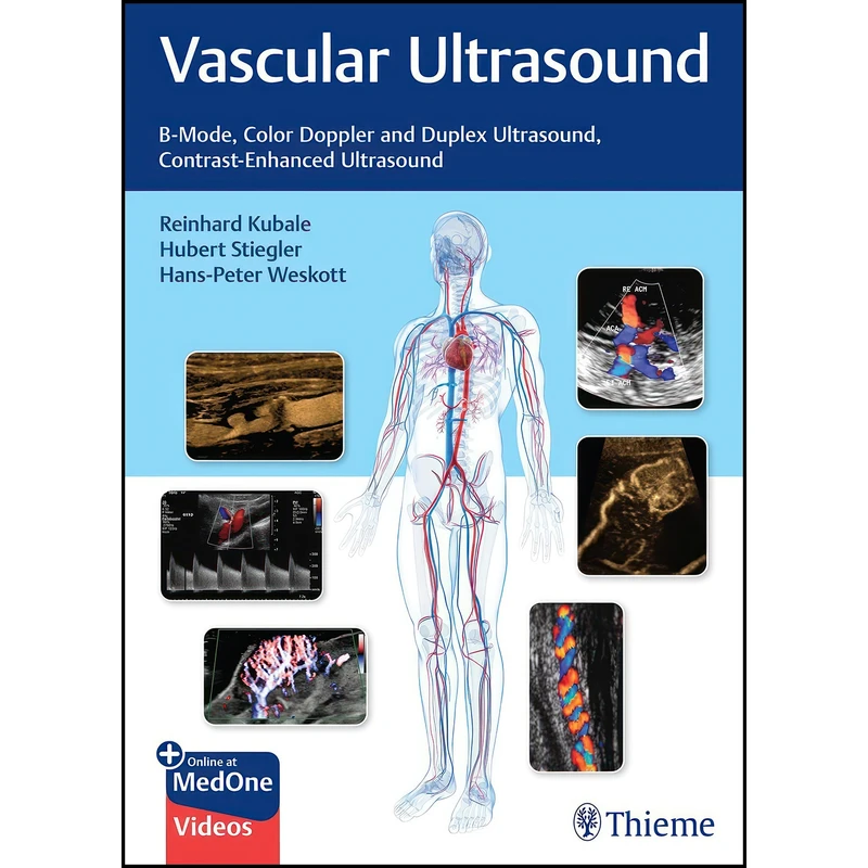 کتاب Vascular Ultrasound اثر جمعي از نويسندگان انتشارات Thieme