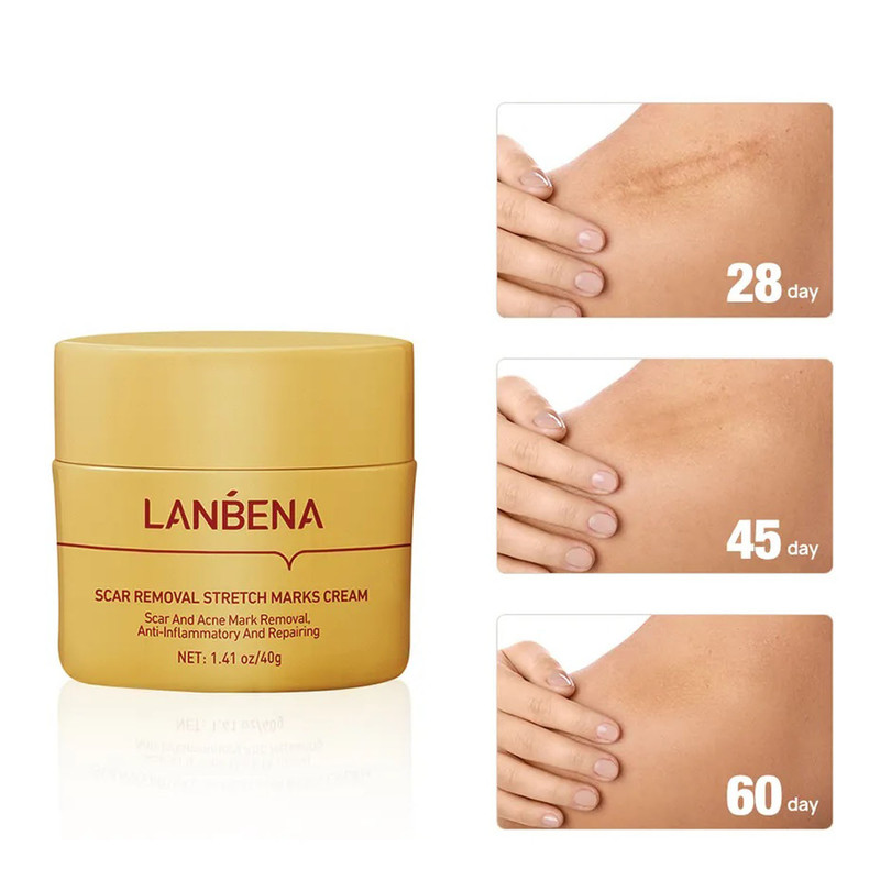 کرم ضد لک لنبنا مدل ضد اسکار وزن 40 گرم