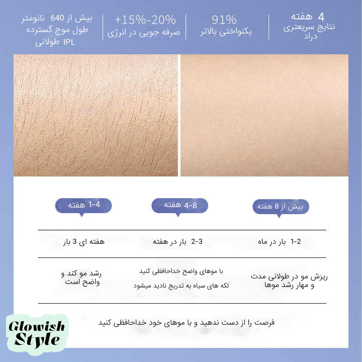 لیزر موهای زائد گلویش استایل مدل IPL-23