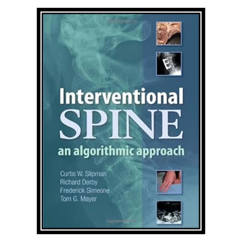 کتاب Interventional Spine: An Algorithmic Approach اثر جمعی از نویسندگان انتشارات مؤلفین طلایی