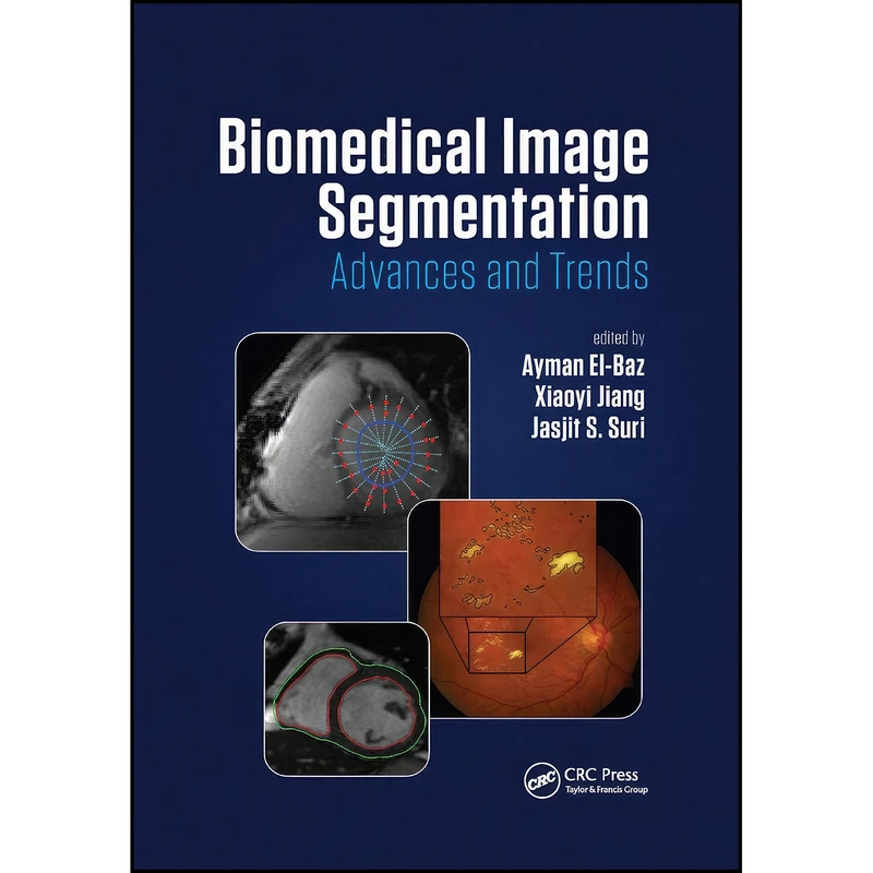 کتاب Biomedical Image Segmentation اثر جمعي از نويسندگان انتشارات تازه ها