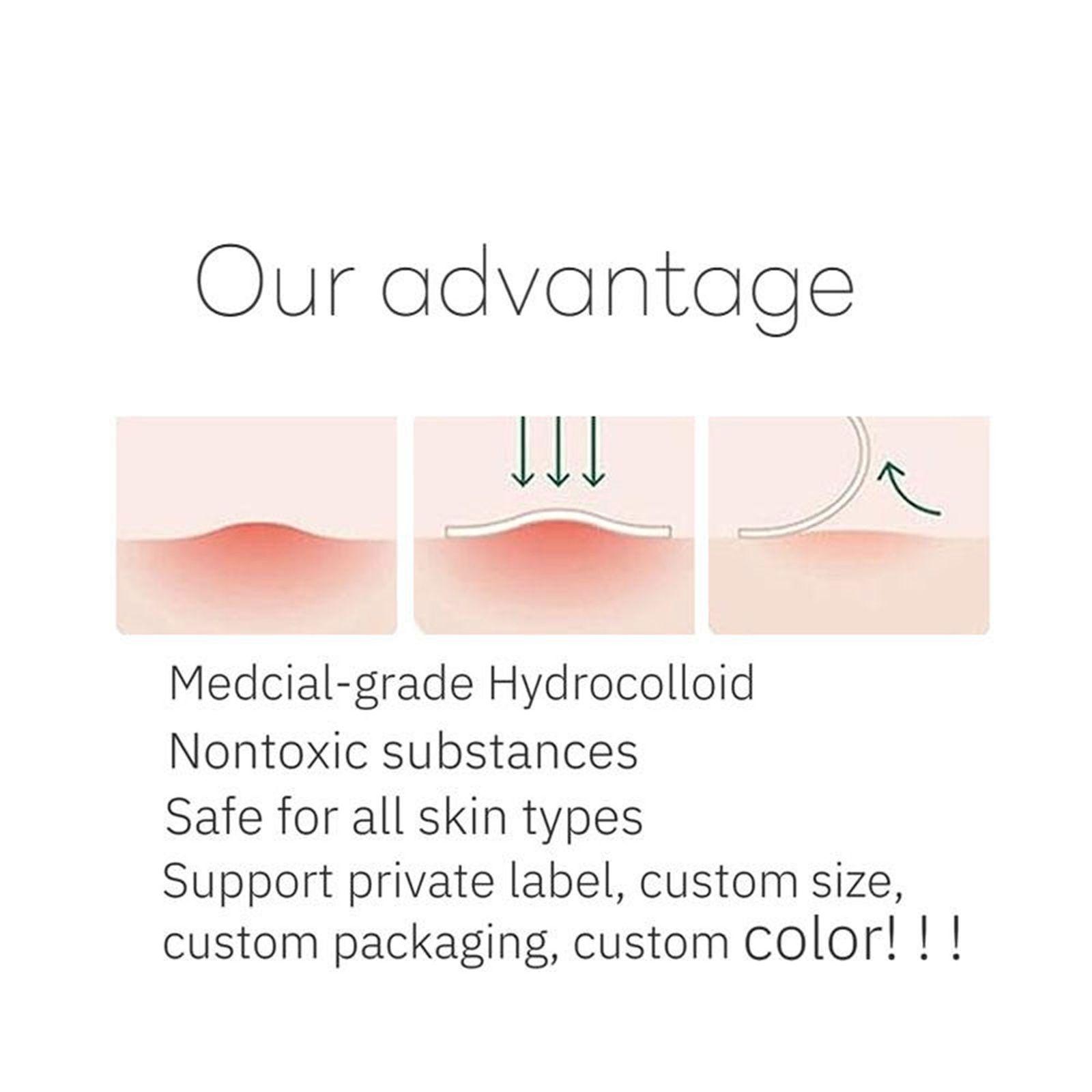 چسب ضد جوش پنرول مدل PRD Acne Cover Patch 360 بسته 36 عددی -  - 12