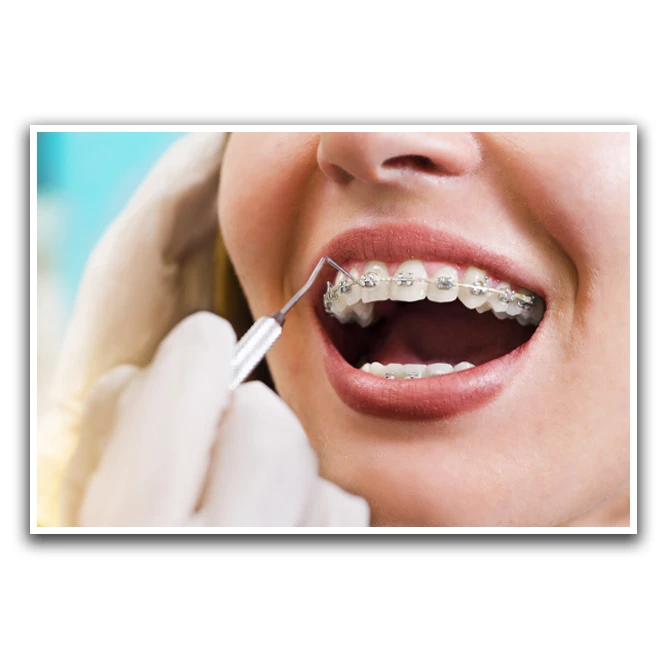 تابلو نوری بکلیت طرح لبخند و دندانپزشکی مدل W-D1240