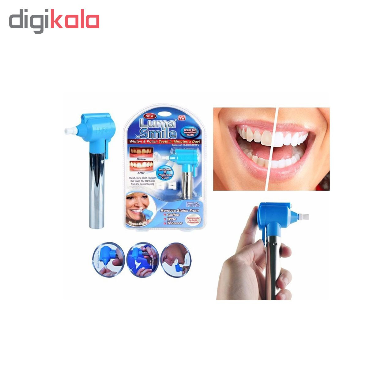 جرم گیر ، لمینت و بلیچینگ دندان لوما اسمایل مدل original2018