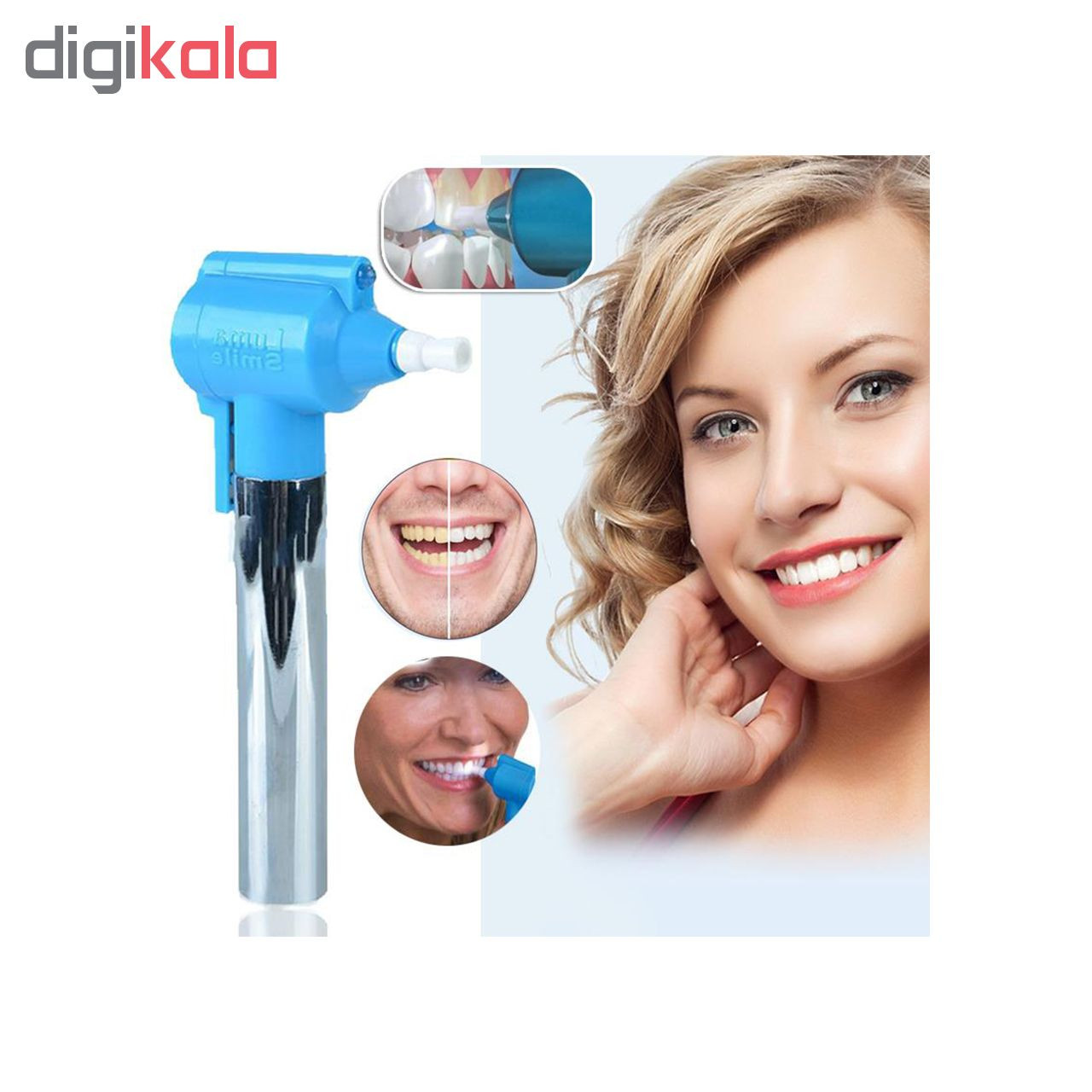 جرم گیر ، لمینت و بلیچینگ دندان لوما اسمایل مدل original2018