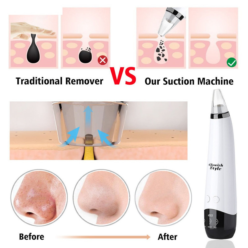 میکرودرم خانگی گلویش استایل مدل MP503