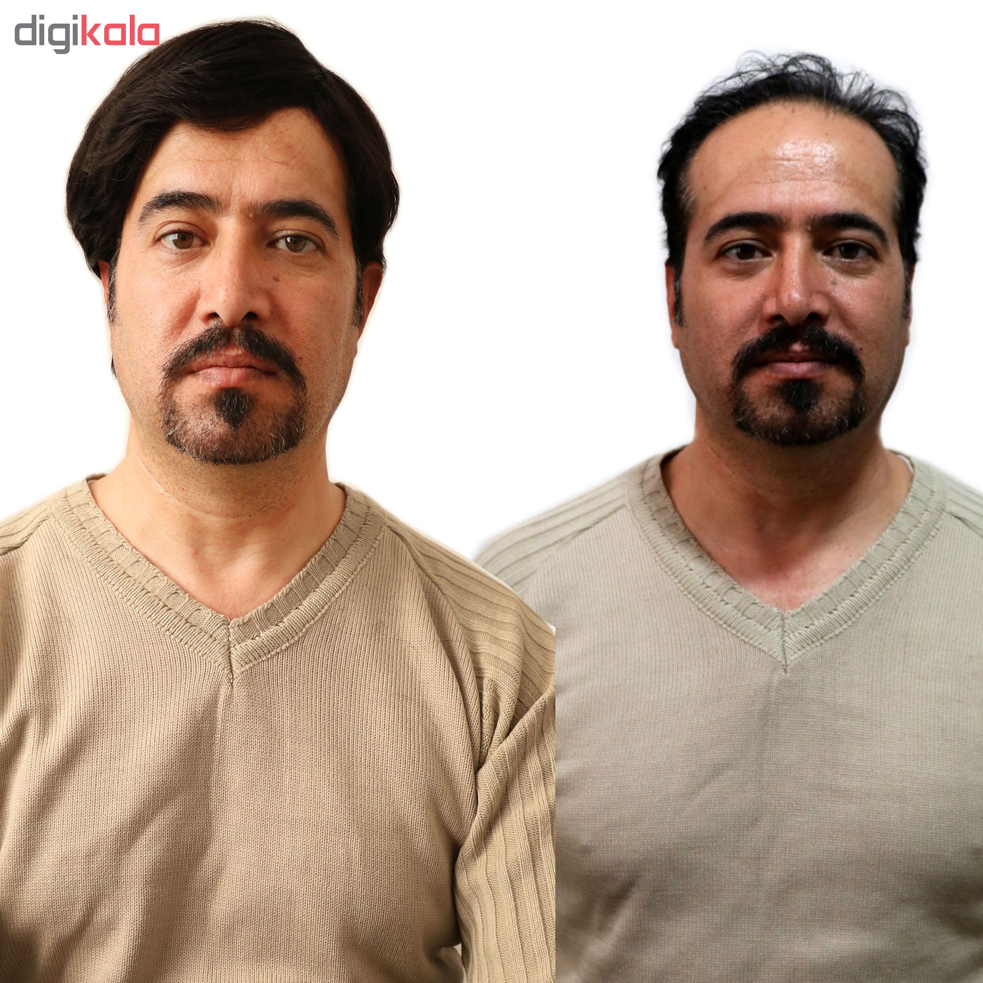 کلاه گیس مردانه کد 5712-4