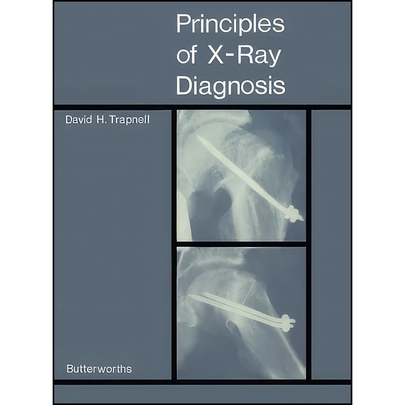 کتاب Principles of X-Ray Diagnosis اثر David H. Trapnell انتشارات تازه ها