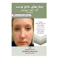 کتاب بیماریهای شایع پوست آکنه، اگزما، پسوریازیس به زبان ساده اثر دکتر احمد محمود آبادی