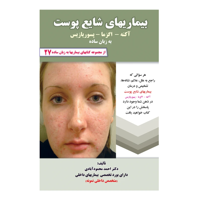 کتاب بیماریهای شایع پوست آکنه، اگزما، پسوریازیس به زبان ساده اثر دکتر احمد محمود آبادی
