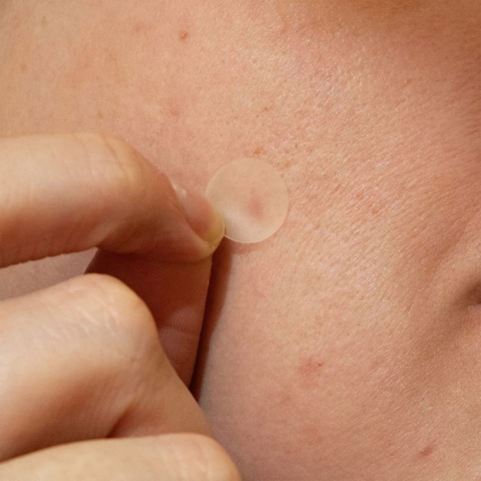 چسب ضد جوش پنرول مدل PRD Acne Cover Patch 360 بسته 36 عددی -  - 15