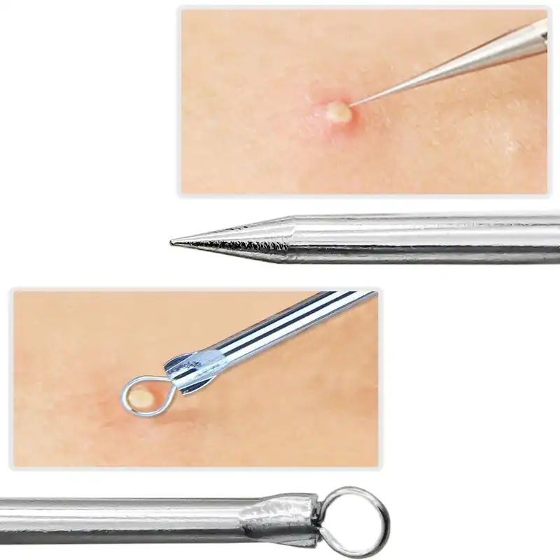 پیلینگ صورت مدل SS-1 بسته 3عددی