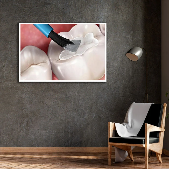 تابلو بکلیت طرح دندانپزشکی مدل W-D2197 فریم سفید