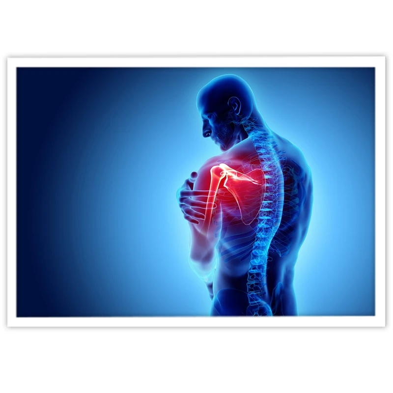 تابلو بکلیت طرح رادیوگرافی مفصل کتف مدل W-10629