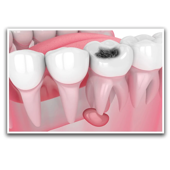 تابلو بکلیت طرح دندانپزشکی مدل W-D1170