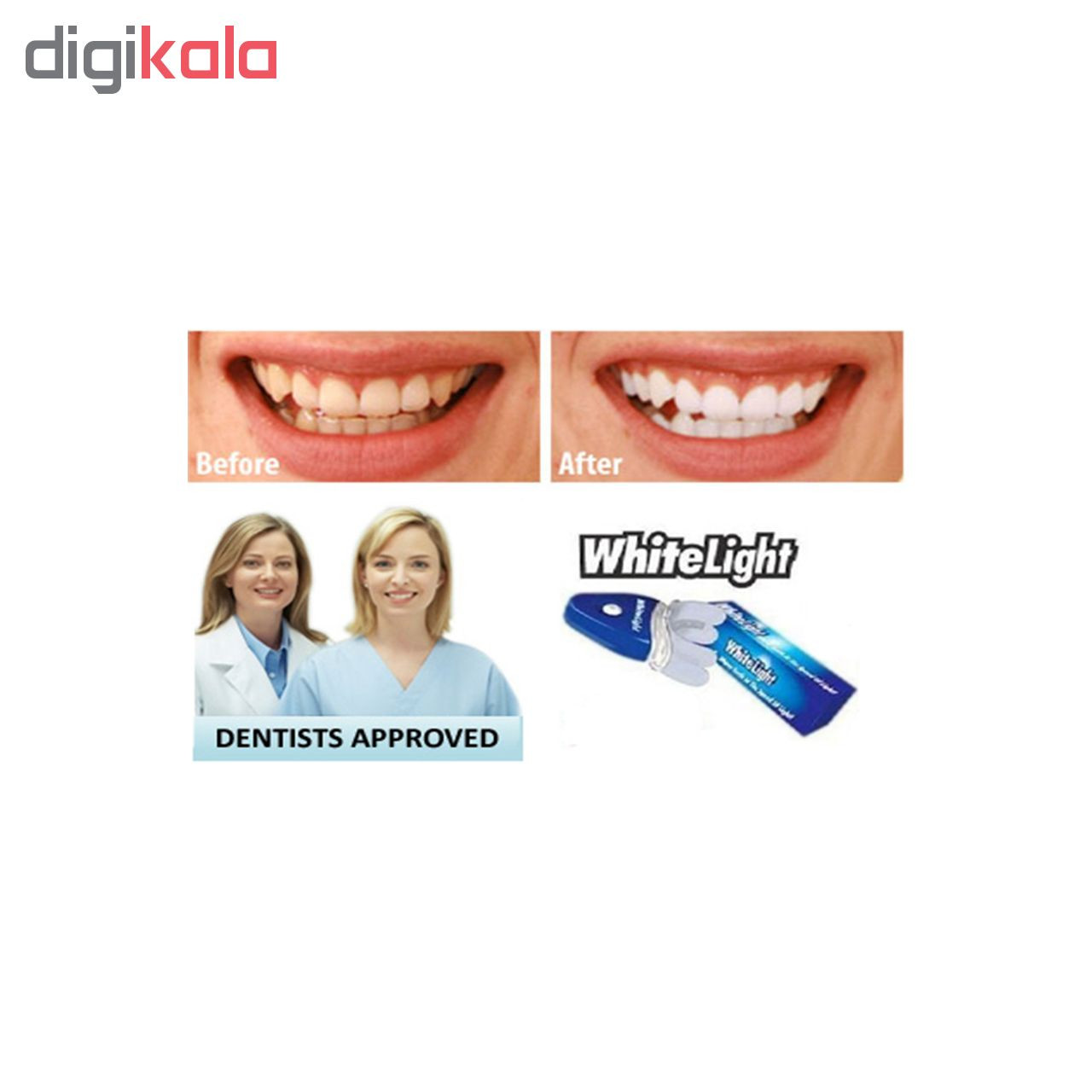 جرم گیر ، لمینت و بلیچینگ دندان وایت لایت مدل White Light NEW original2019