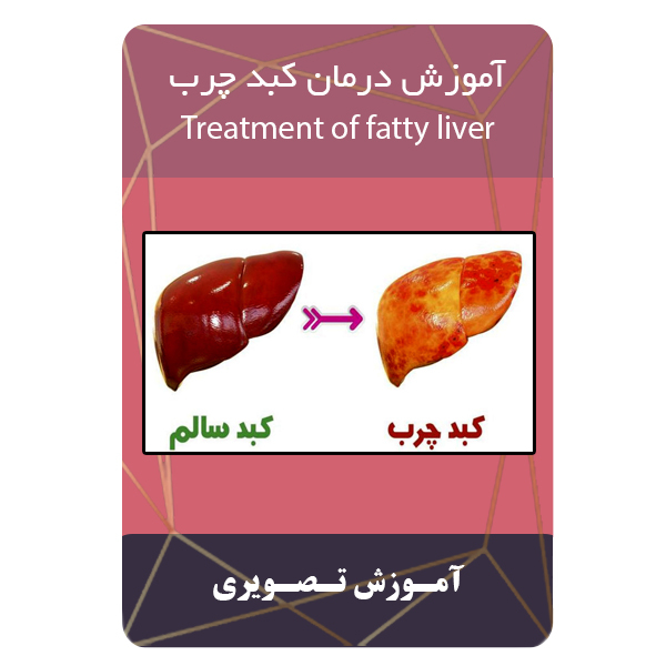 ویدئو آموزش درمان کبد چرب نشر برج