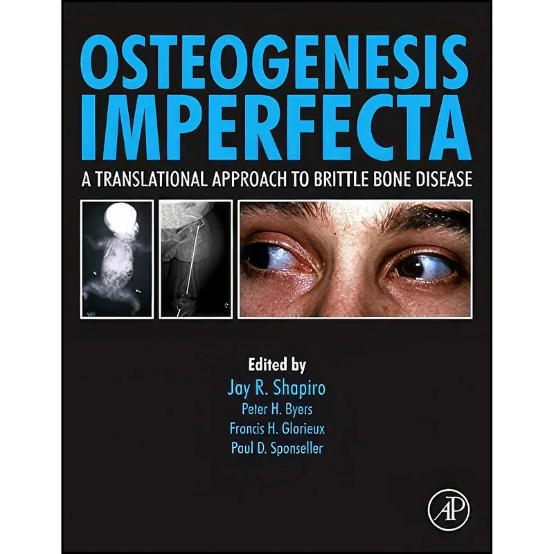 کتاب Osteogenesis Imperfecta اثر جمعي از نويسندگان انتشارات Academic Press