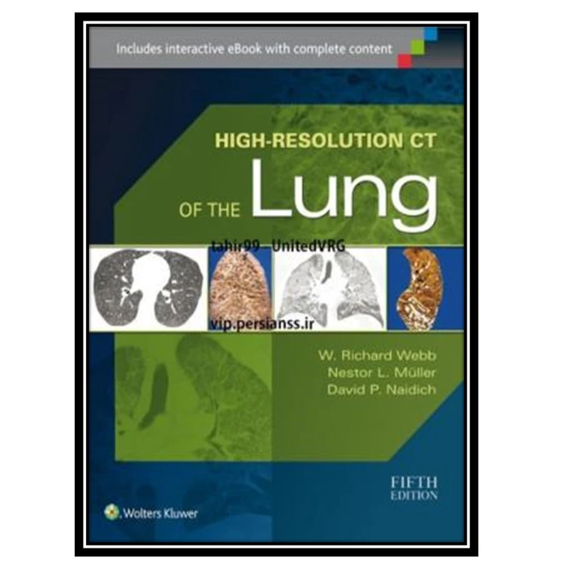 کتاب High-Resolution CT of the Lung اثر جمعی از نویسندگان انتشارات مؤلفین طلایی