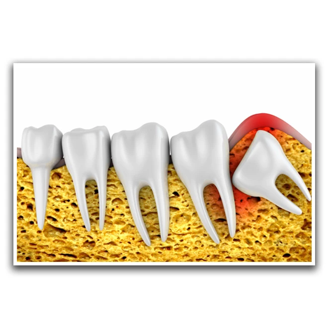 تابلو نوری بکلیت طرح ریشه دندان مدل W-D1167