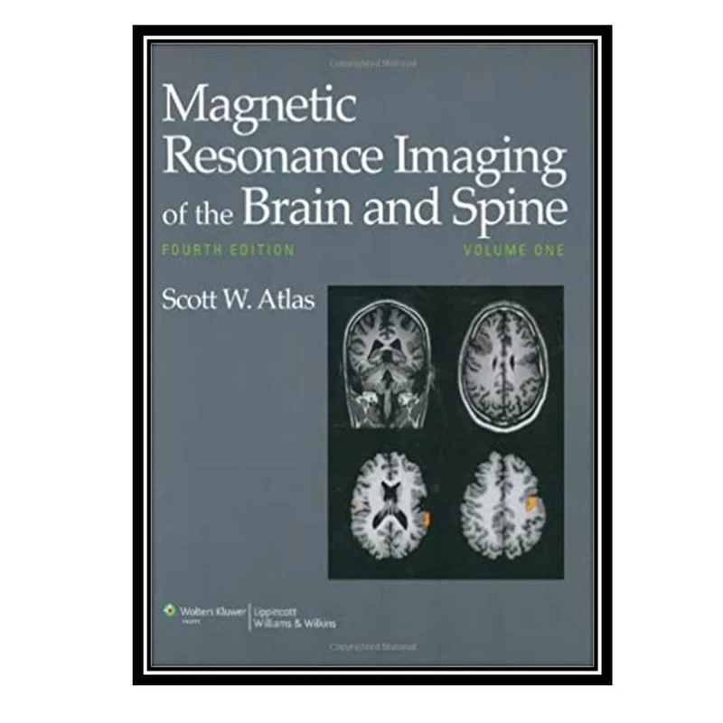 کتاب Magnetic resonance imaging of the brain and spine2 اثر Scott W Atlas انتشارات مؤلفین طلایی