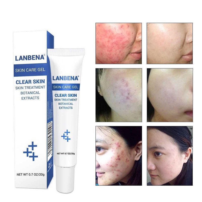 ژل ضد جوش لنبنا مدل جینسینگ حجم 30 میلی لیتر ژل ضد جوش لنبنا مدل جینسینگ حجم 30 میلی لیتر