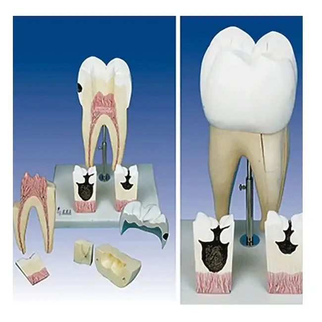 بازی آموزشی مدل مولاژ اولین دندان آسیاب فک تحتانی