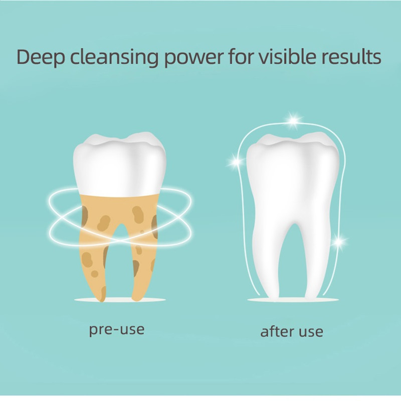 دستگاه شست و شو و جرم گیر دهان و دندان مدل JYQ-002