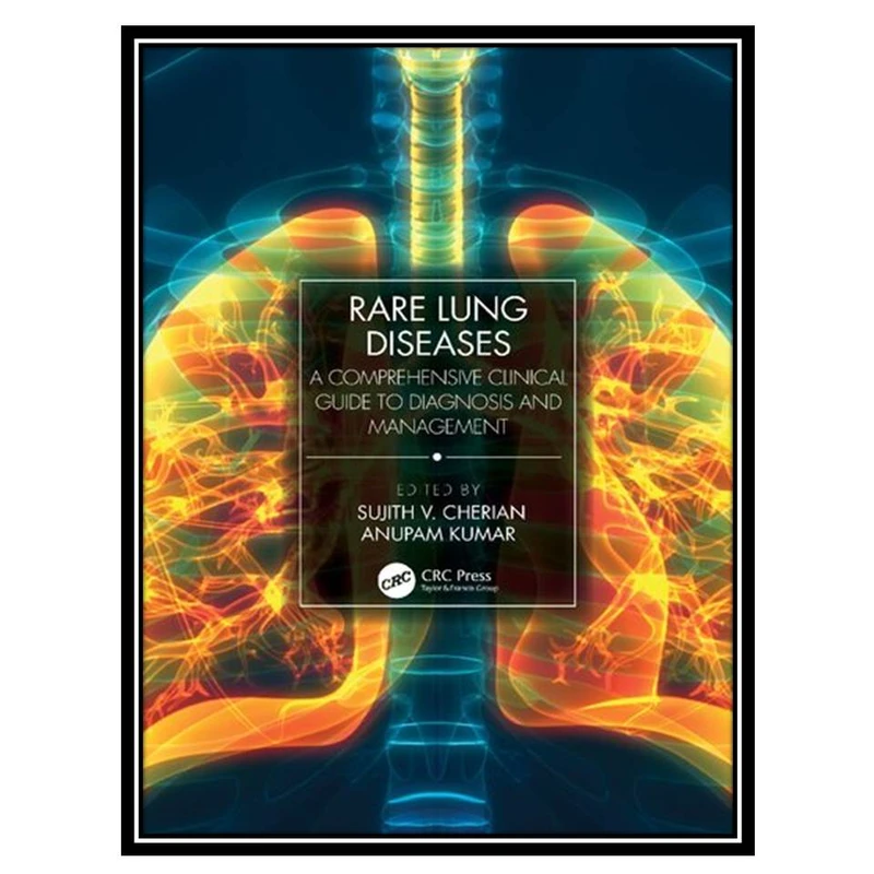 کتاب Rare Lung Diseases اثر Sujith V. Cherian and Anupam Kumar انتشارات مؤلفین طلایی