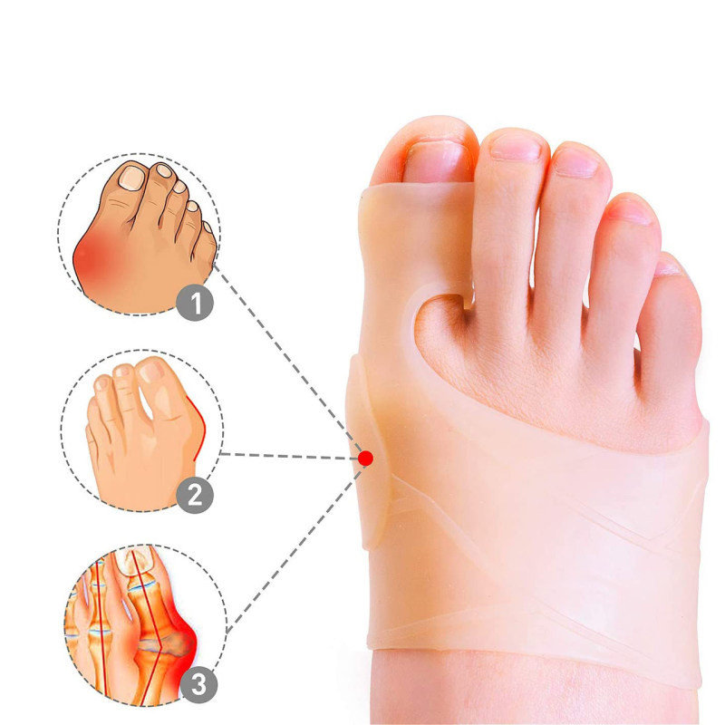 پد هالوکس والگوس دکتر فوت مدل A020 بسته 2 عددی