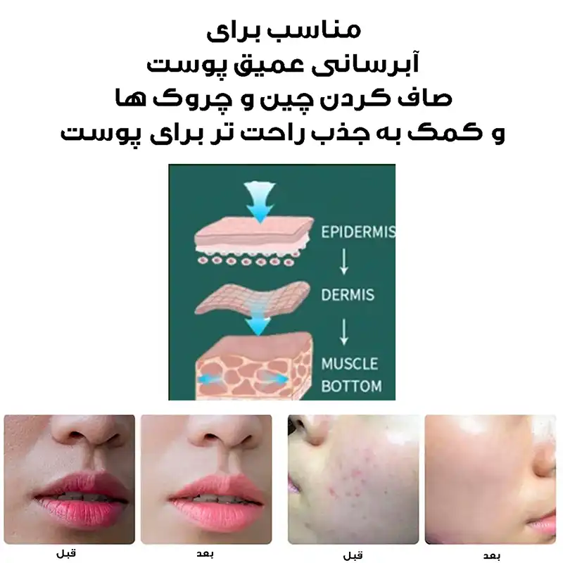 دستگاه آبرسان پوست کد ZM150